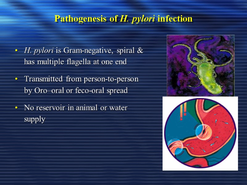 Pathogenesis of H. pylori infection  H. pylori is Gram-negative, spiral & has multiple